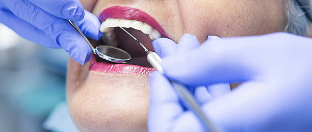 Best Emergency Tooth Extraction in Zellwood, FL